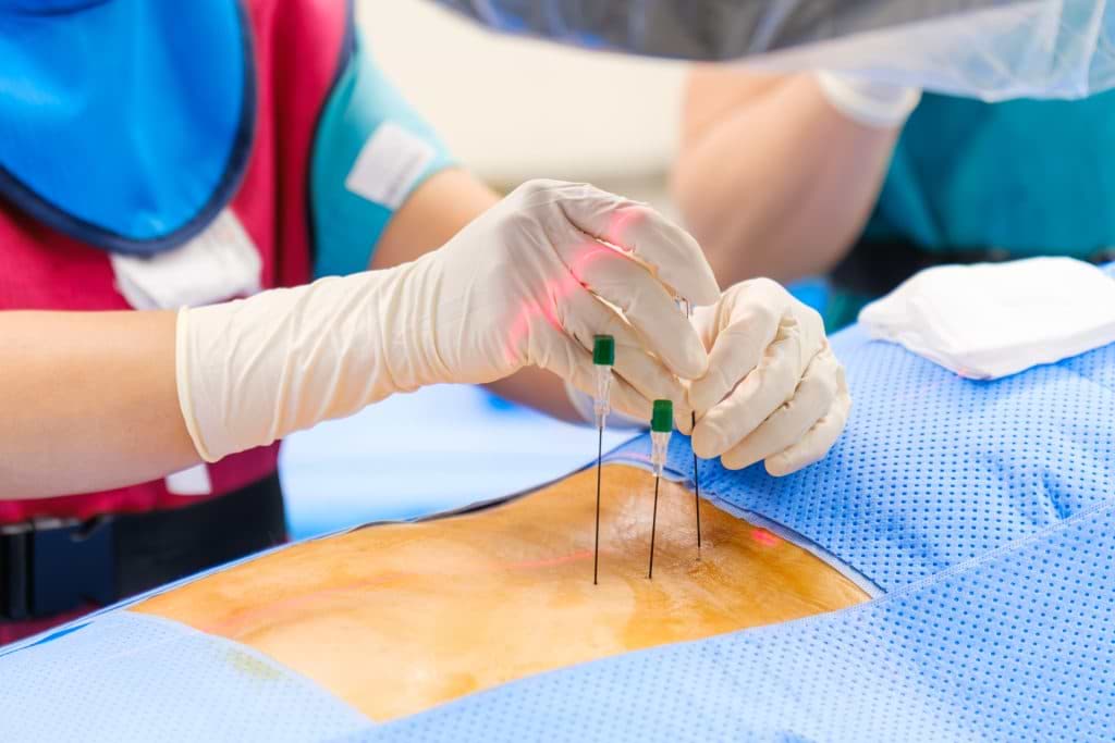 Regenerative & Injections